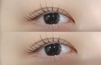 一重・奥二重さんの目元が劇的に変わる!まぶたの厚みを計算した「垢抜け」アイデザイン